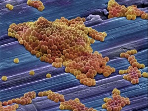 staphylococcus aureus